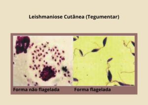 Leishmaniose Cutânea maior