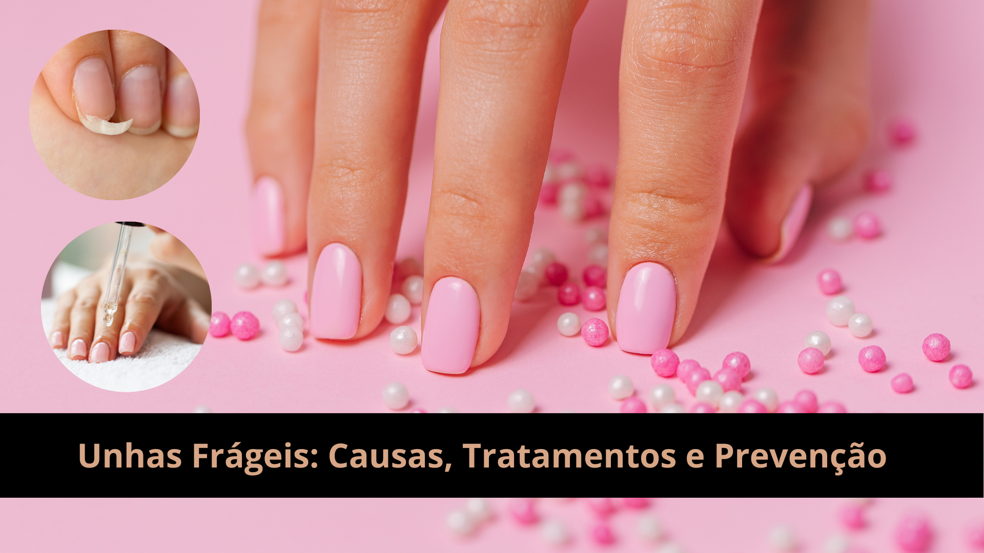 Unhas Frágeis